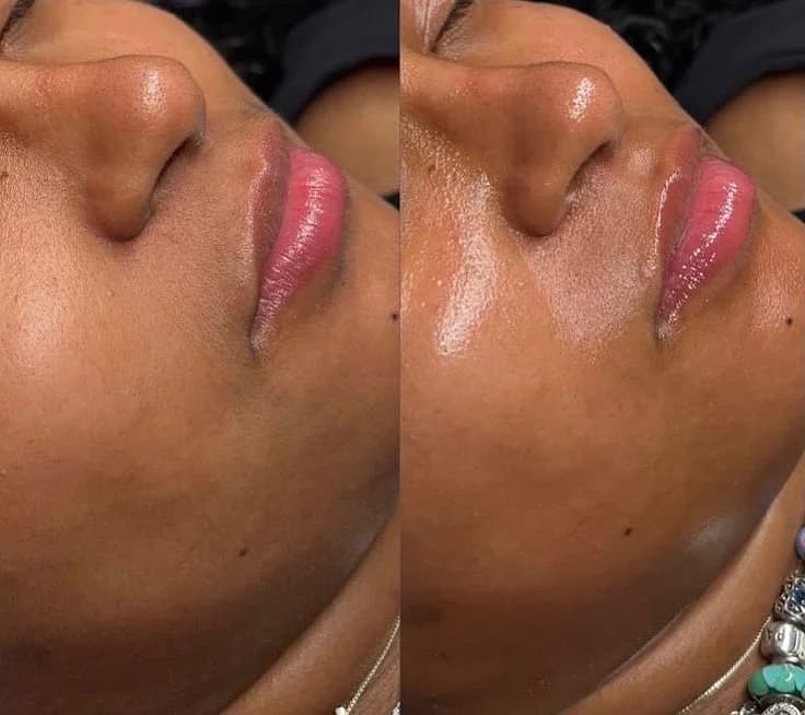 Face - Ladies treatment at Comfort Wax